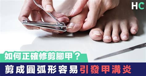 剪腳|【生活知識】如何正確修剪腳甲？剪成圓弧形容易引發。